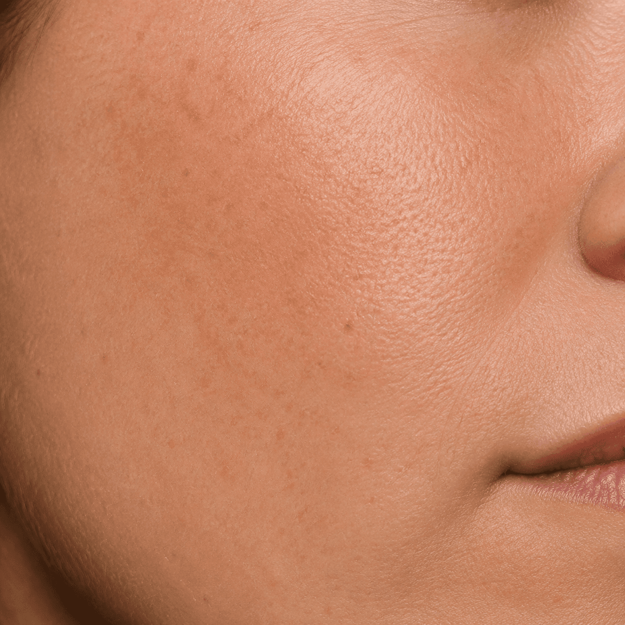 Close-up skin photograph used in the SkinToScan awareness story